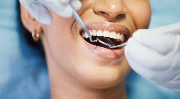 Best Emergency Root Canal Therapy in Anderson, CA